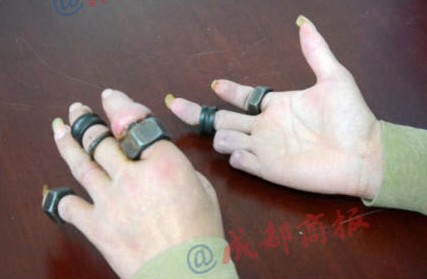 <em>乐山</em>一疑似智障流浪汉手指戴满铁螺帽取不掉-