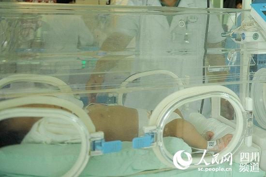 幸运宝宝还在PICU(儿童重症监护室)接受治疗(吴婕 摄)