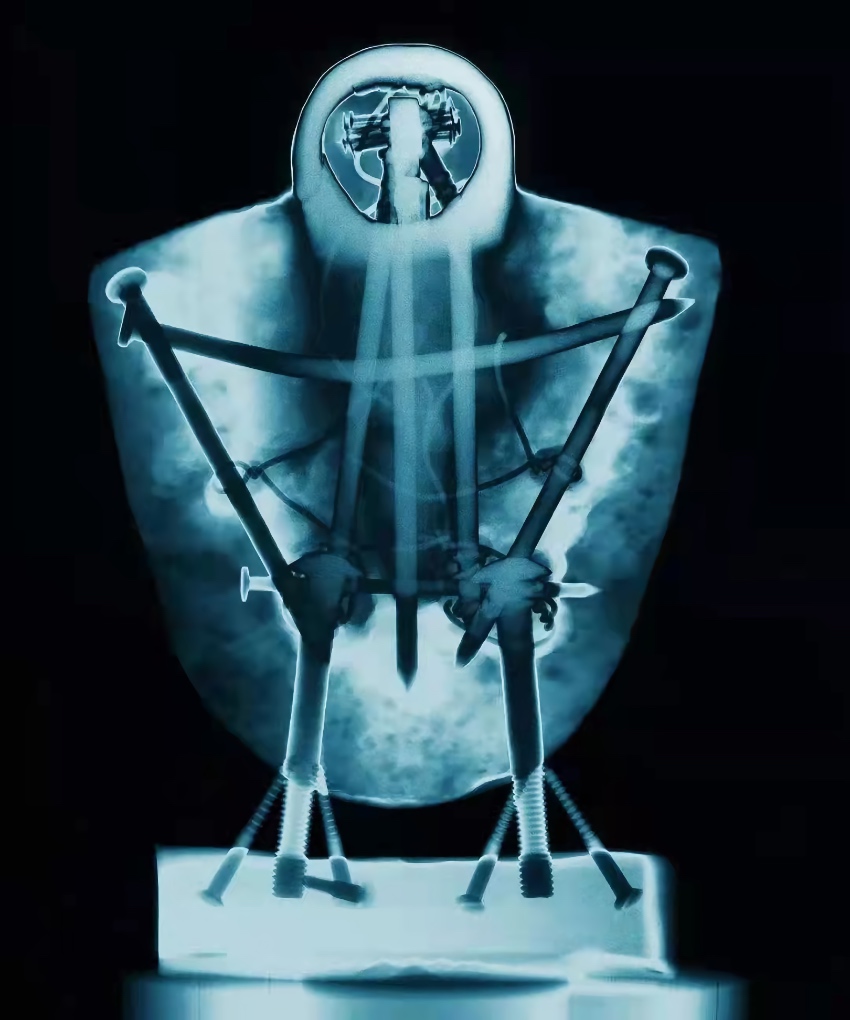 “不可見·X射線下的藝術”展作品。錦江外宣供圖