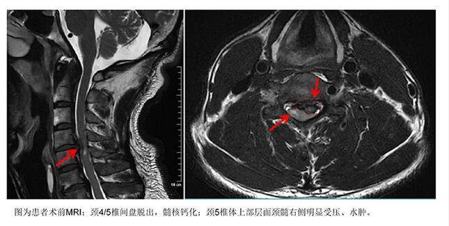 患者手术前影像照片。四川泰康医院供图