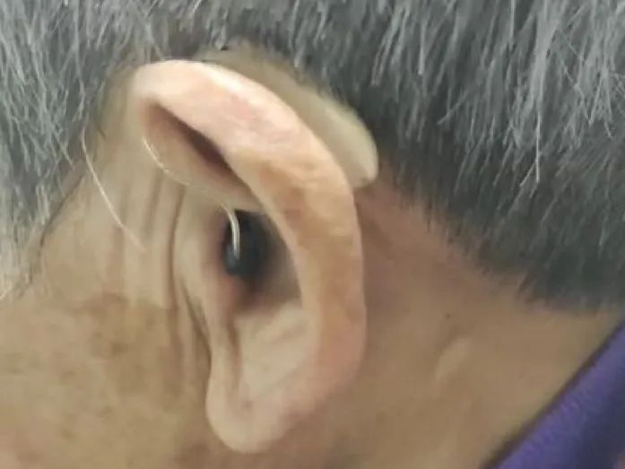 一位老人戴著助聽器。徐田莉供圖