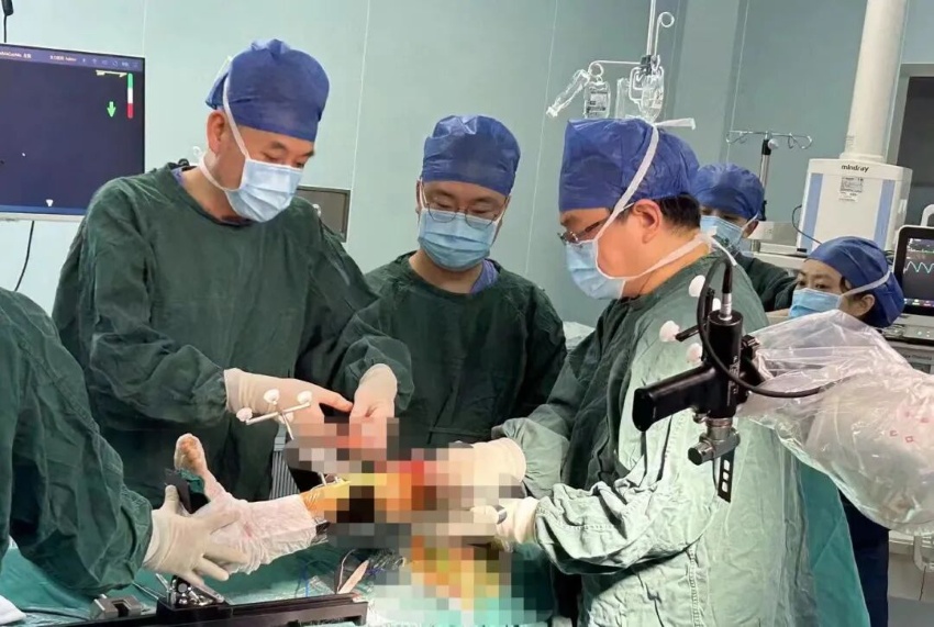 刘永光在手术中认真操作。四川省第四人民医院供图